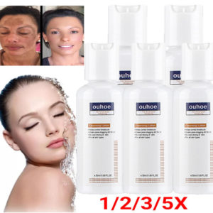 Skinenjoy Cleansing Lotion for Acne & Spots & Acanthosis Nigricans, Body Wash US