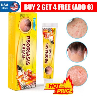 Health Care Psoriasis Cream Eczema Ointment Scalp Psoriasis Hand Tinea Foot HOT!